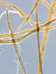 Micrograph of unrefined fibres
