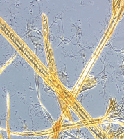 Micrograph of LC refined fibres