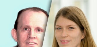 MARKETISSUES: Global tissue trade is beset by physical problems. So why is AI not more widely used to solve them?